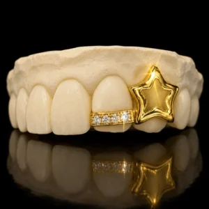 Diamond Star Grillz