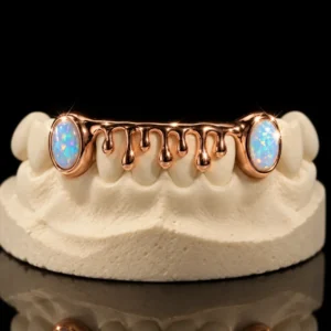 Rose Gold Grillz